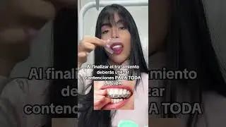 COSAS que NO SABÍAS sobre usar ORTODONCIA (brackets) #shorts