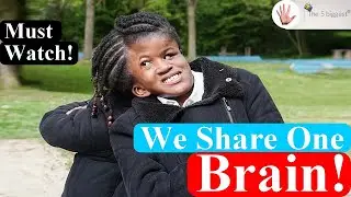 Conjoined Twins Neev and Nelly: I Wish I Had Seen This Before ~ Body Bizarre!