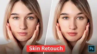 Skin Retouching | Face Retouching | High - End Skin Retouching
