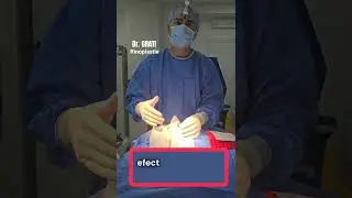Intinerire facială prin rinoplastie