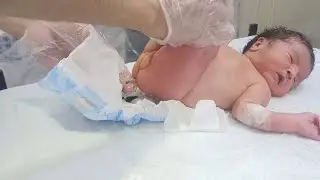 💊 Suppository Use in Newborns | Dr. Sam NICU Care | Relieving Pain, Discomfort 