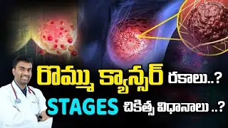 రొమ్ము క్యాన్సర్ చికిత్సలో మూడు ప్రధాన పద్ధతులు ఉంటాయి | Breast cancer treatment |Dr Sumanth| Kaizen