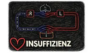 Rechts- vs Links- Herzinsuffizienz einfach erklärt