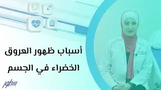 أسباب ظهور العروق الخضراء في الجسم