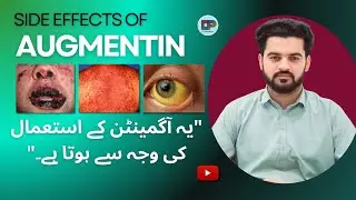 Side effects of Augmentin By Doctorspharma official.