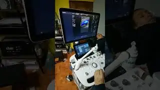Un resumen sobre Doppler con énfasis en el examen venoso.