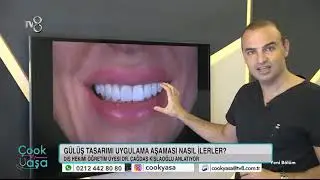 Gülüş Tasarımı:  Doğal ve sade mi? Yoksa cesur ve iddialı mı?