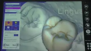 EXOCAD