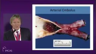 Lecture: Dermal Filler Complications