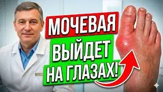 Who would have thought that gout is afraid of the common... One product - and the attacks go away