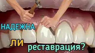 Надежна ли реставрация?