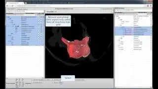 Pubanatomy 3D Tree grid -- 2 add/remove/sort/filter structures