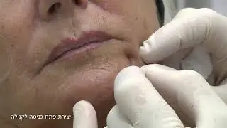סדנת תיאוסיאל 2019 - פיסול פנים עם קנולה ומזרק אוטומטי