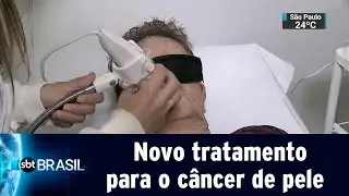 Novo tratamento para o câncer de pele tem taxa de cura de 95% | SBT Brasil (27/04/19)