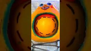 КЕСАРЕВО СЕЧЕНИЕ|  Фруктовый Врач