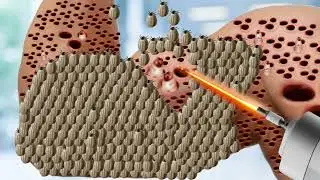 ASMR Treatment 2D Animation | Treatment Dog Ticks Infected in Hands | @HealAsmr914K