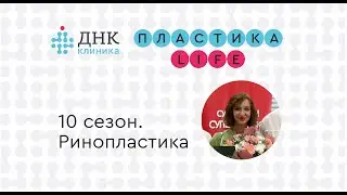 "Пластика Life" 10 сезон. Ринопластика