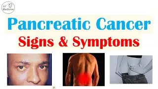 Pancreatic Cancer Signs & Symptoms (& Why They Occur)