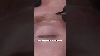 Isso faz seu PÊLO ficar ENCRAVADO!