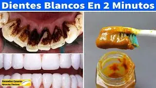 👉 Usa Esta Pasta De Dientes, La Placa Y El Sarro Desaparecerán Rápidamente