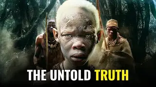 The SHOCKING Hunt On AFRICAN ALBINOS!!