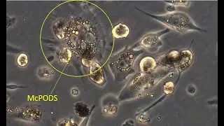 Macrophage-mediated localized release of cytokines using PODS