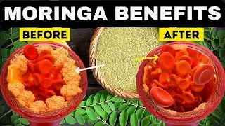 6 Amazing Health Benefits Of Moringa Oleifera | Moringa Powder Benefits