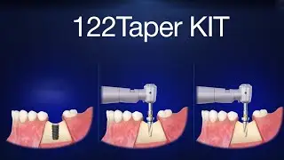 122 Taper KIT