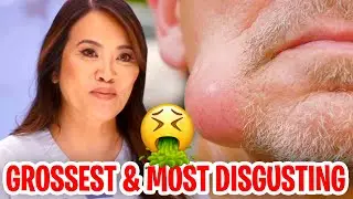 The GROSSEST and MOST DISGUSTING Moments on Dr. Pimple Popper!