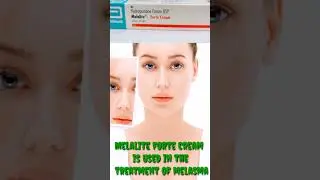 skin-lightening medicine, melasma,darkened skin patches and spots , melalit forte cream,dark skin