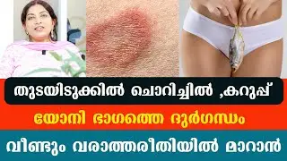 തു.ടയിടുക്കിൽ ചൊറിച്ചിൽ ,കറുപ്പ് ,യോ.നി ഭാഗത്തെ ദുർഗന്ധം വീണ്ടും വരാത്തരീതിയിൽ മാറാൻ / Dr Thrishna