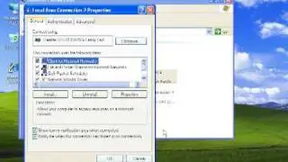 Windows XP - obtain an IP address automatically