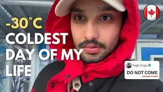 I went out at -30°C in Canada… bad decision