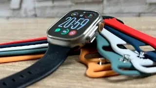 Best Affordable Apple Watch Bands: Stylish and Durable Picks!"