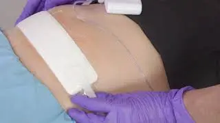 PICO 7 Application C-section 10x30cm