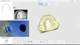 1часть: CAD\CAM. 3D cканирование в Medit, EXOCAD моделирование. Временные конструкции и 3D печать.