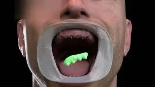 Dentistry Dentures adaptation - Removable dental prostheses