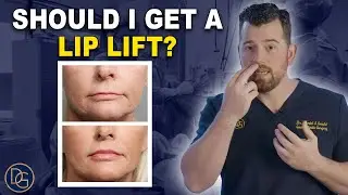 Lip Lift: The Hot Topic for Anti-Aging Around the Mouth