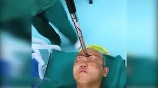 ТОП 8 ЧУДОМ ВЫЖИВШИХ ПОСЛЕ СМЕРТЕЛЬНЫХ РАН_Full-HD.mp4