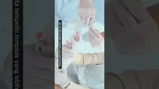 Tips Pasang GIPS: Fraktur Phalanx