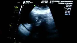 100_3441.MOV