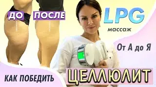LPG массаж от целлюлита / Все, что вы хотели знать про LPG и целлюлит