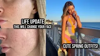 Life update! I got a face procedure! New makeup products/routine! Spring White Fox clothing haul!