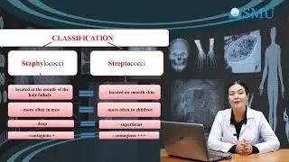 Infectious diseases of the skin:Bacterial Infections