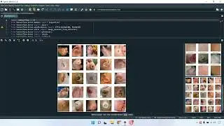 A Survey of Wound Image Analysis Using Deep Learning Classification, Detection, and Segmentation all