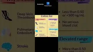 D-dimer test