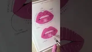 lip filler injection #lipfiller #lipfillerinjection #russianlipfiller