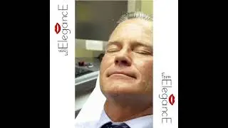 preenchimento facial   masculina