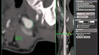 MILLENSYS Vision Tools 3Dview Vessel Analysis Software