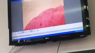 Гистология. Яичник и Желтое тело матка Яйцевод (Женская половая)